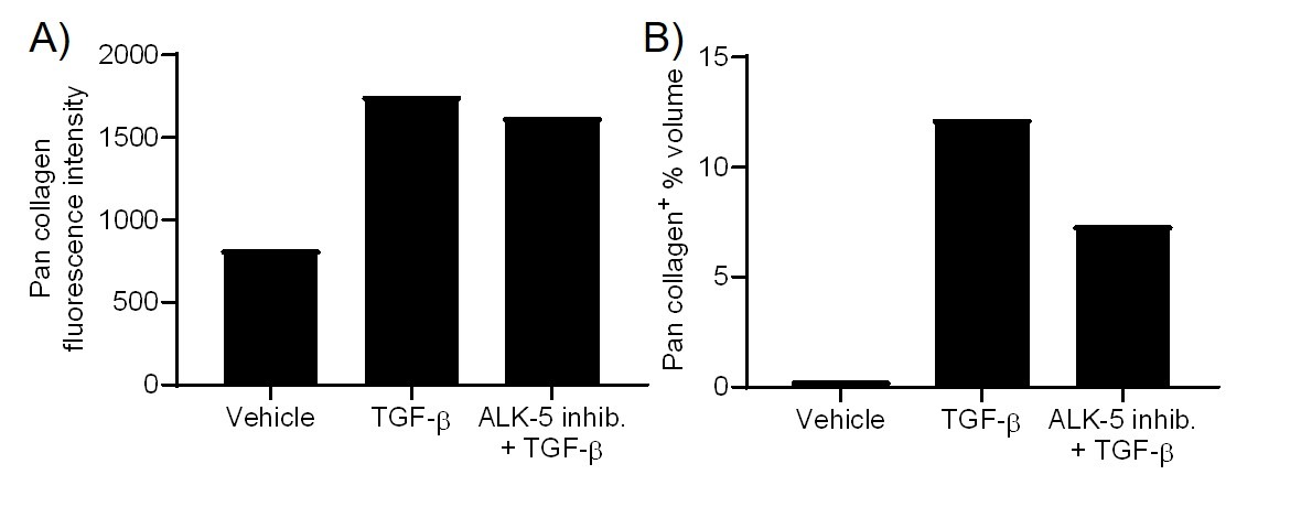 20190131_website_fibrosis quant