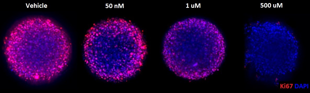 Montage Ki67 cisplatin spheroids