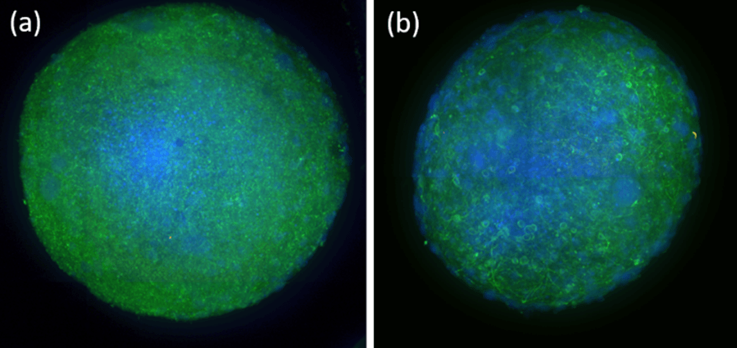 Neuronal Organoid Comparison