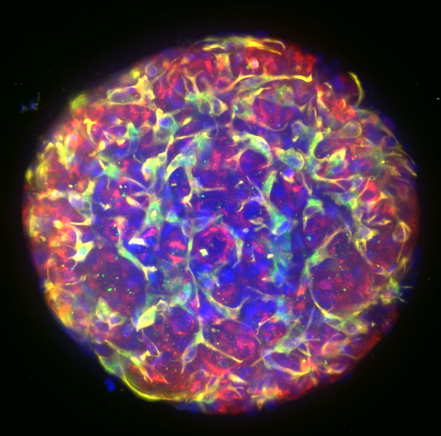 Open Liver HepaRG NP_DAPI_CD68_Albumin_Vimentin