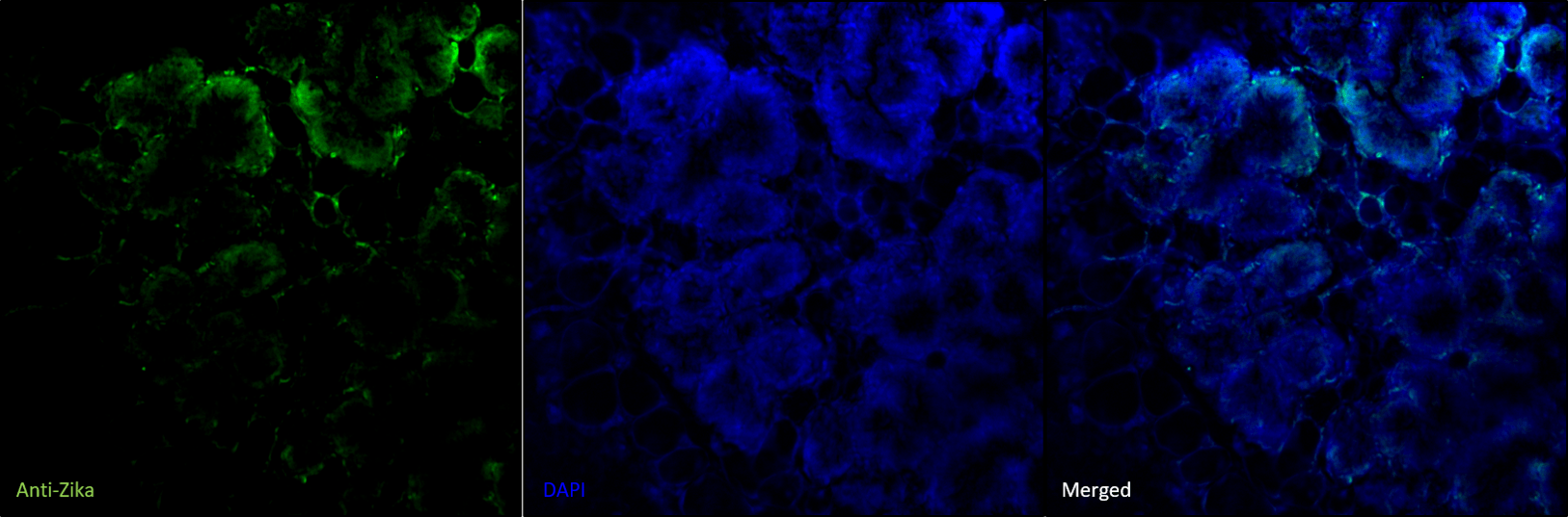 Viral Infection Page – Figure 1