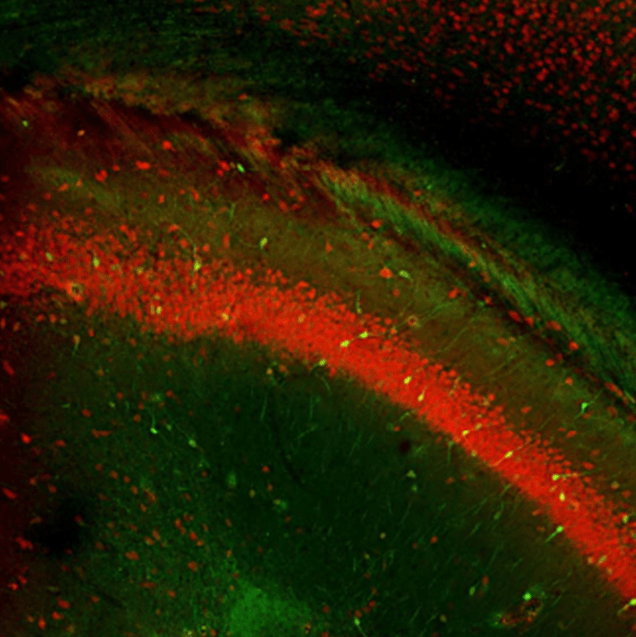 rb‐Fox3 NeuN (red‐546 ) ch‐Calr (green‐488) Dapi (blue‐405) Rat Brain