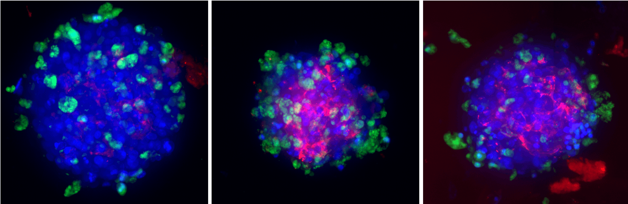Fibrosis and Steatosis Assay 3D Cell Culture