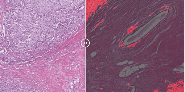 Quantitative Digital Pathology - 3Screen™ | Visikol