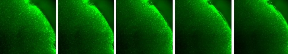 Control brain stained with S100b antibody