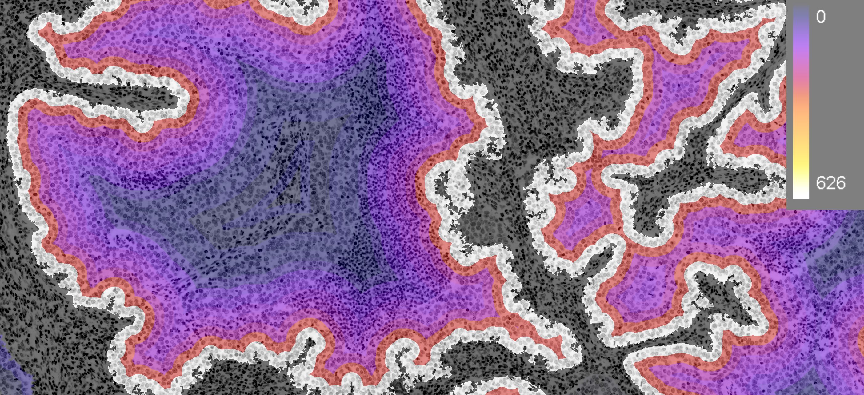 Immuno-oncology Heat Map Overlay