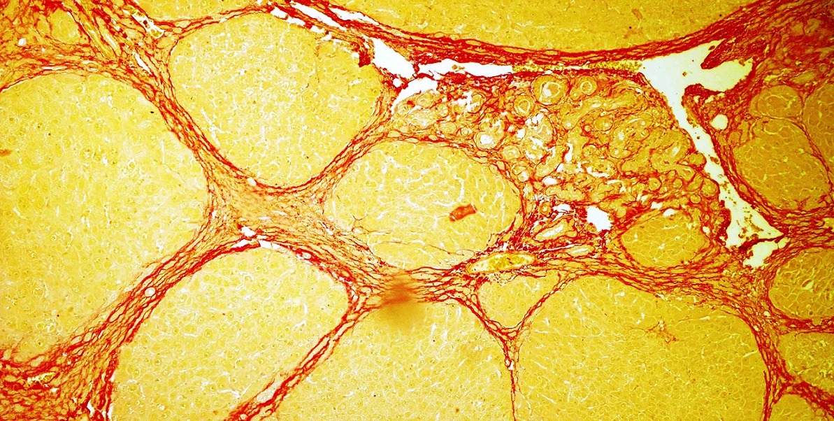 Doxycycline 200mg tablet | Shaanxi Bloom Tech Doxycycline 200mg tablet | Shaanxi Bloom Tech