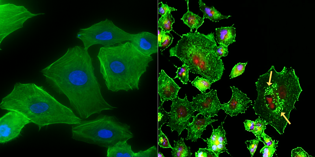Cell Painting for the Visualization of Varying Phenotypic Expressions