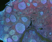 Antibody Multiplex Image