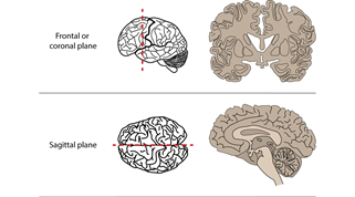 Mouse Brain Image