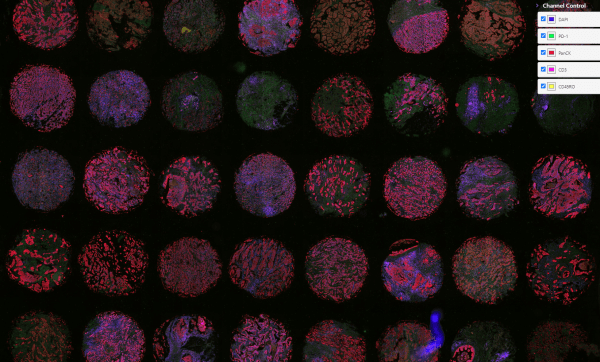 reast-Cancer-TMA-DAPI