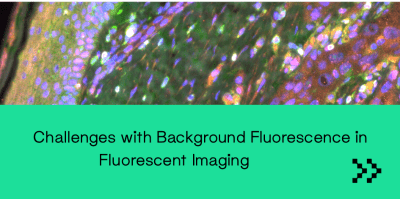 Challenges with background fluorescence in fluorescent imaging
