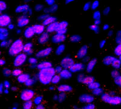 HCR Image of Spatial Profiling