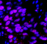 40X imaging of B-actin RNA with HCR RNA-FISH (red) and DAPI (blue)