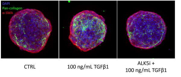 NASH-NAFLD