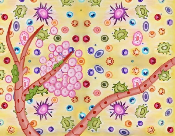 Schematic representation of Tumor Microenvironment.