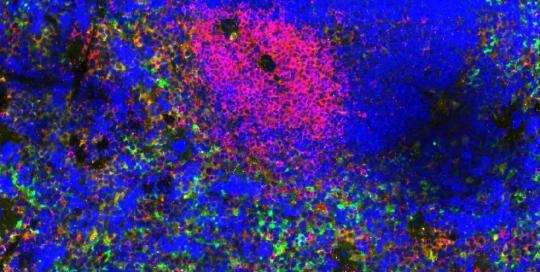 Blocking Buffers in Immunofluorescence Workflows