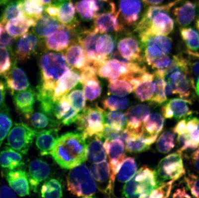 Cells Colored with Cell Painting Technique