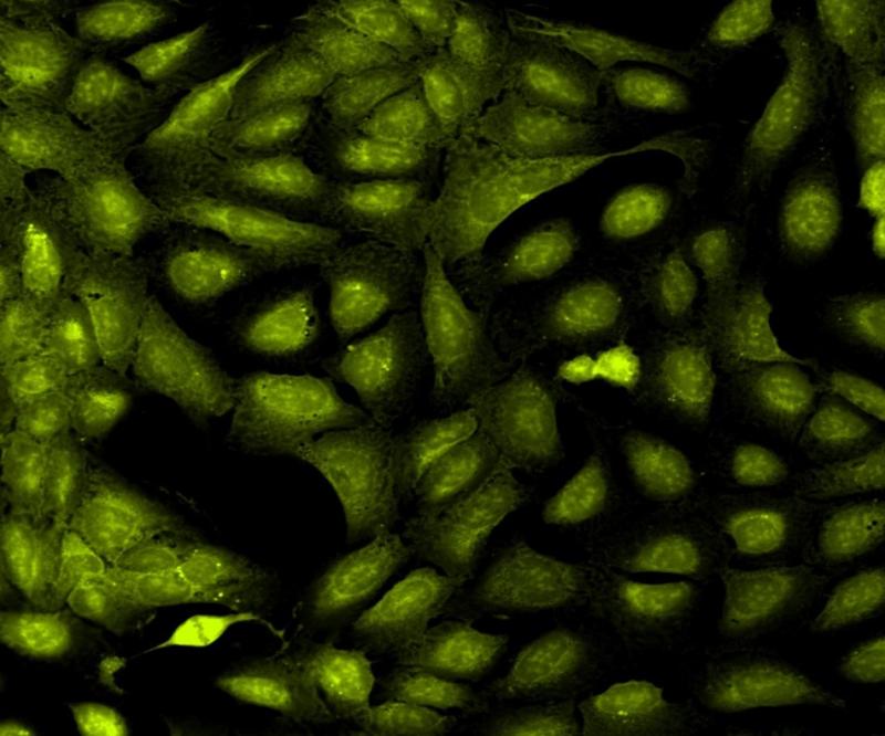 Using Cell Painting for Morphological Changes