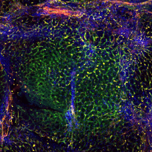 PCLSAntibodies2