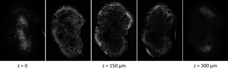 Retinal Organoid