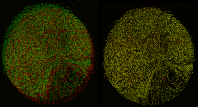 Figure 1: Core A before (left) and after (right) co-registration. The red signal represents the fixed image, while the green represents the moving image. After the moving image is transformed, the resulting composite image exhibits almost complete overlap, depicted by the bright yellow color.