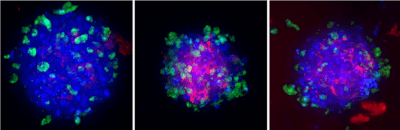 Visikol HepaRG/NP 3D spheroids were pretreated with either vehicle or an ALK-5 inhibitor for 1 h prior to inducing fibrosis with 100 nM TGF-β for 48 h. DAPI in blue, viability indicator in green, pan collagen in red.