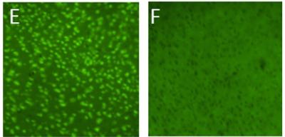 FJ-C labeling in tissue samples of KA- and saline-treated animals following incubation with FJ-C compatible tissue-clearing media: