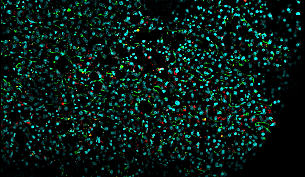 : Planar (2D) view of liver tissue, showcasing the DAPI, alpha-SMA, and Pan Collagen signals after background correction.