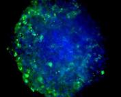 Blue circle with specks of green along the outside. Maximum Z-projection of Z-stack obtained from High Content Imaging of tumor spheroids in the presence of activated and naive immune cells.