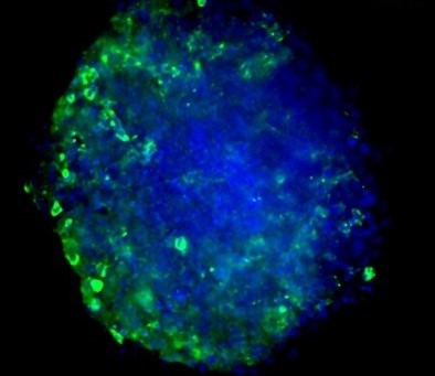 Blue circle with specks of green along the outside. Maximum Z-projection of Z-stack obtained from High Content Imaging of tumor spheroids in the presence of activated and naive immune cells.